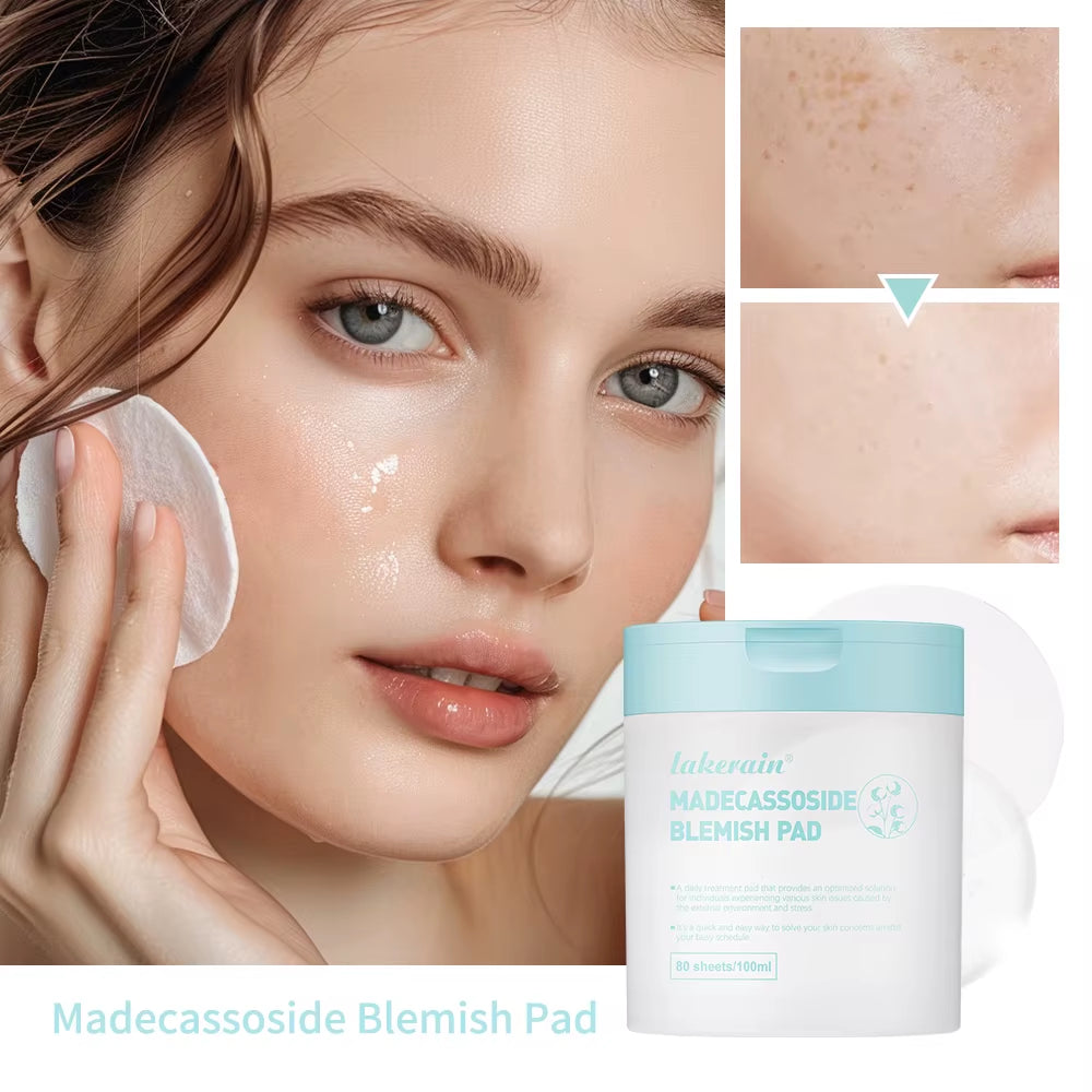 Teatree Pad Facial Toner with Tea Tree and Lactobacillus Soothing Cotton Pad for Sensitive Acne Skin Vegan Facial Gauze Skin Car